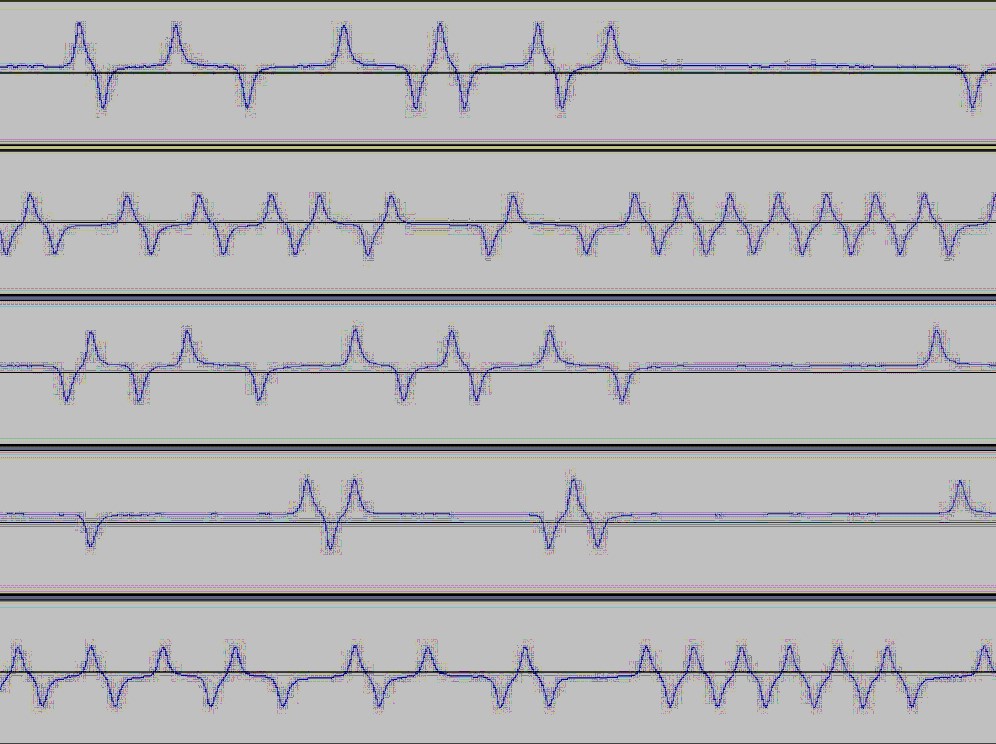 analogue readout